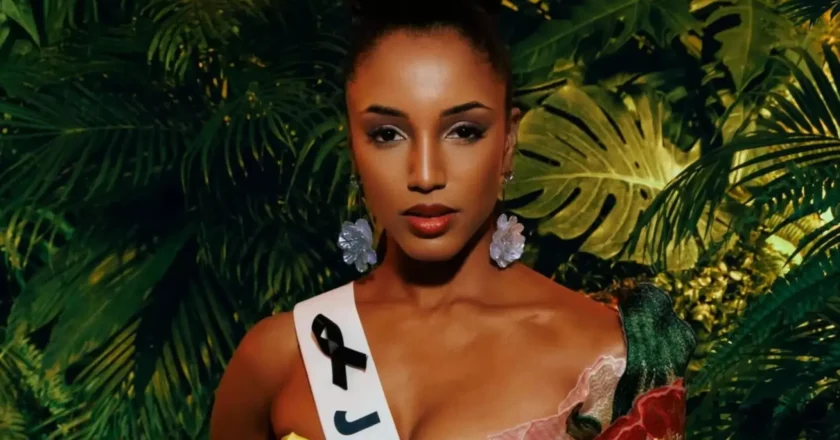 Miss Jamaica recebe alta após tratamento de recuperação