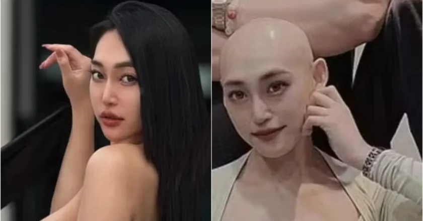 Influenciadora confunde câncer com lesão e morre aos 29 anos