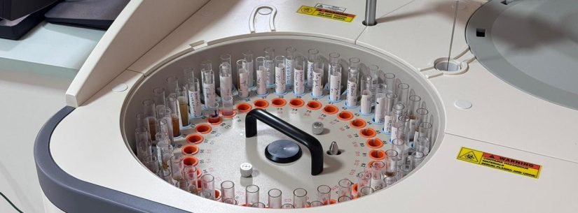 Caraguatatuba ganha laboratório de análises clínicas